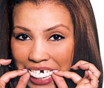 snap on smile snap-on-smile
