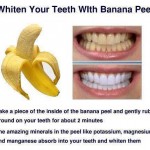 Clareamento Dental com casca de banana – a maior trollada odontológica da história da humanidade!