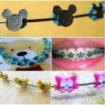 borrachinhas de aparelho do Mickey e da Minnie