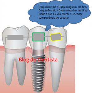 implante dentário