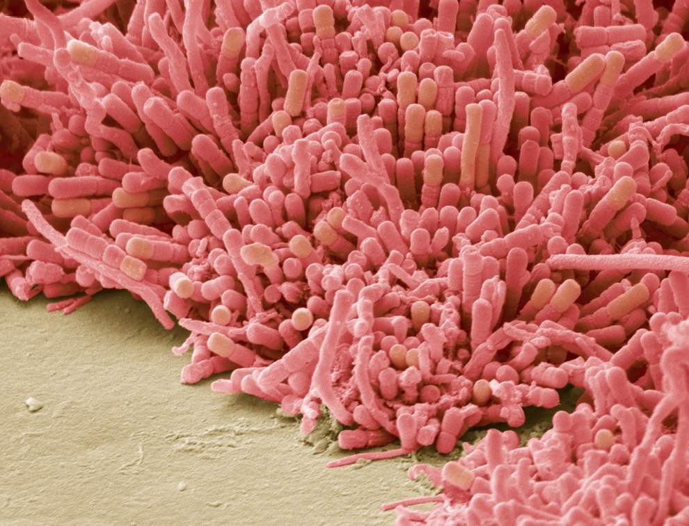 10 imagens feitas com microscópio eletrônico em dentes
